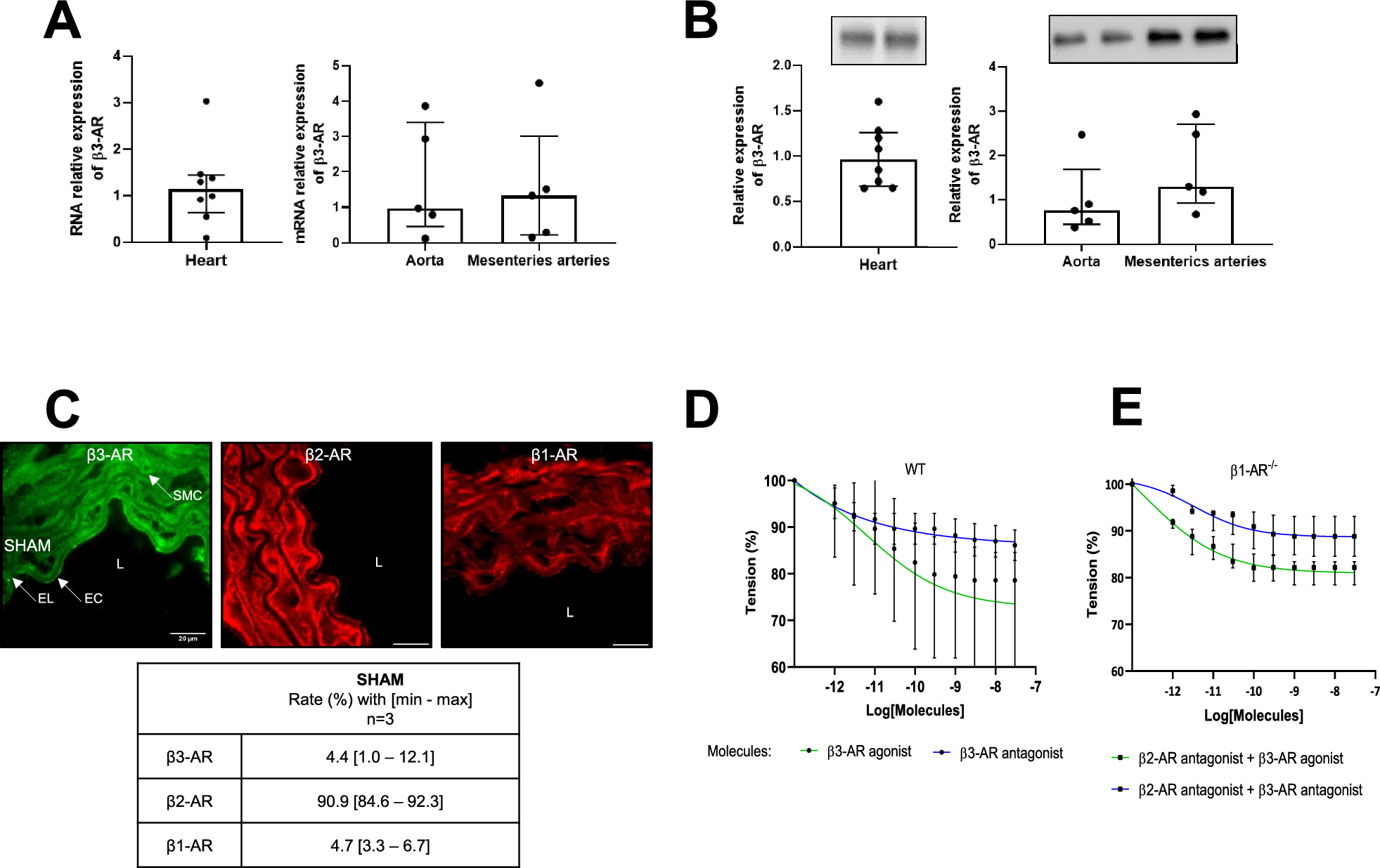 β3-Adrenergic receptor antagonism improves cardiac and vascular functions but did not modulate survival in a murine resuscitated septic shock model