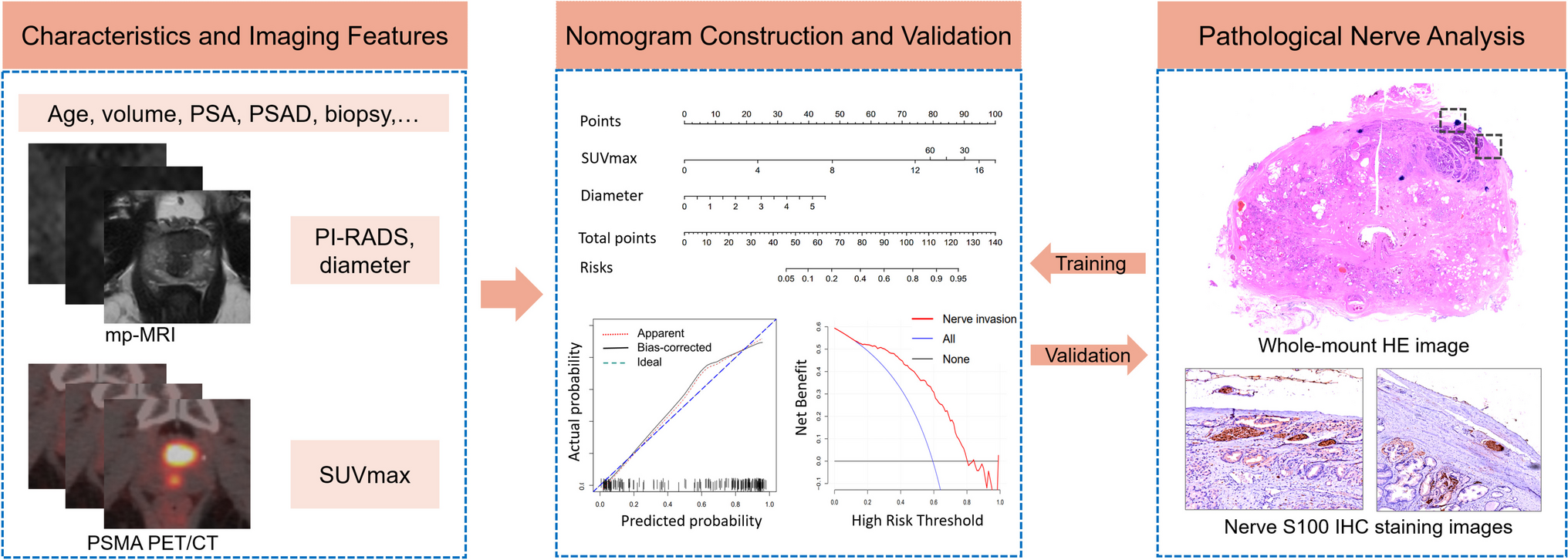 68Ga-PSMA PET/CT-Based Model Predicts Perineural Invasion of Prostate Cancer with Whole-Mount Sections