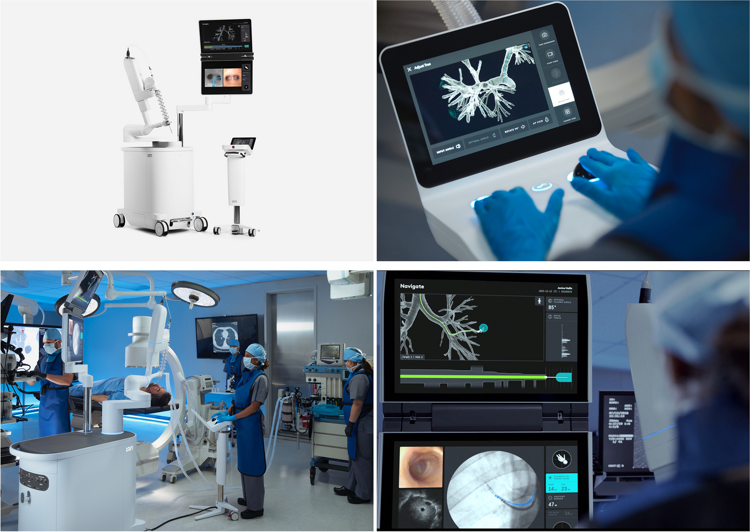 Transbronchial Approach to Peripheral Lung Lesions- How Good are the Robotic and Non-Robotic Approaches Compared with CT Guided Biopsy?