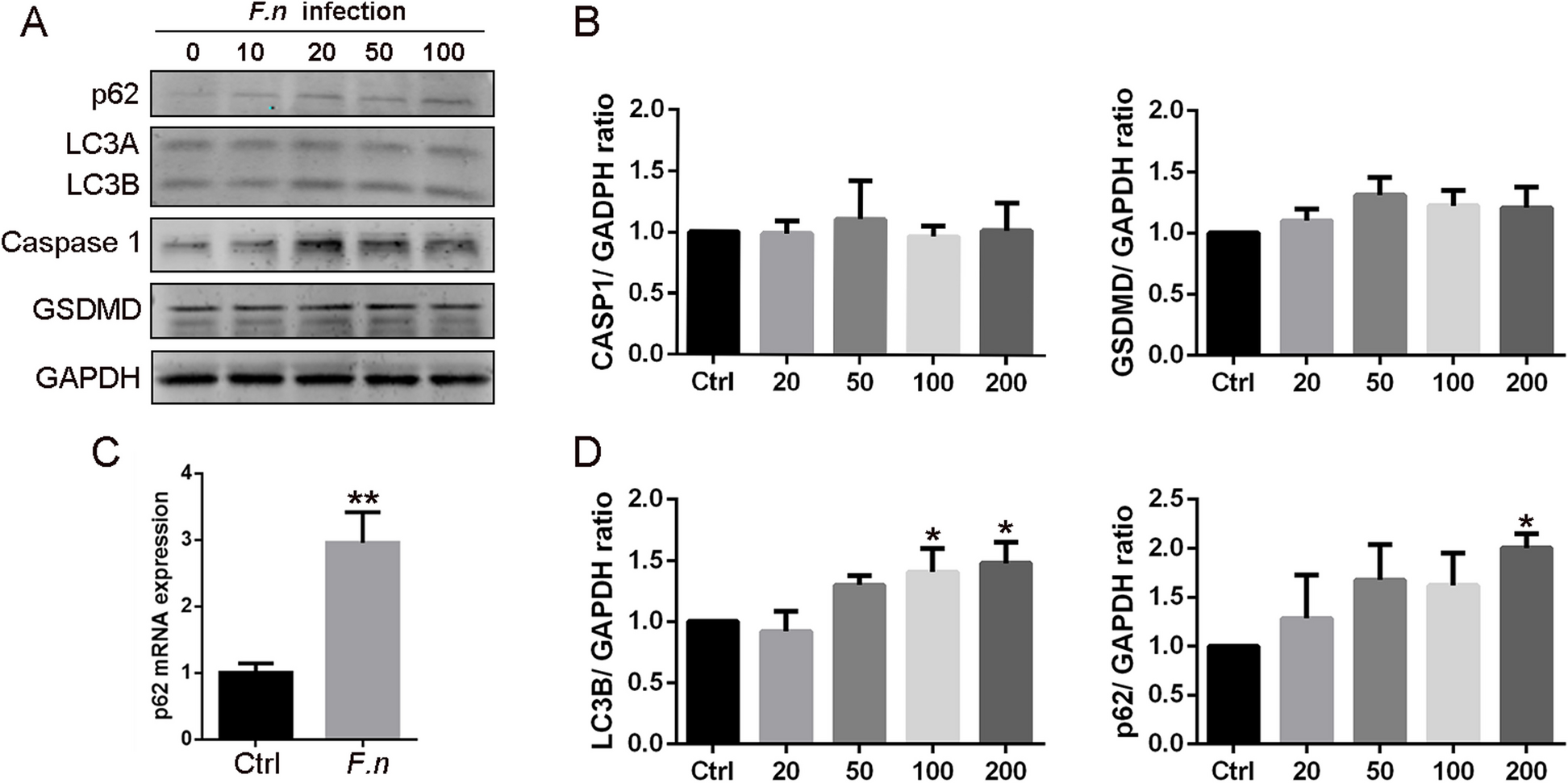 Guanylate-binding protein 5-mediated autophagy can promote the clearance of intracellular F. nucleatum in dental pulp cells during pulpitis