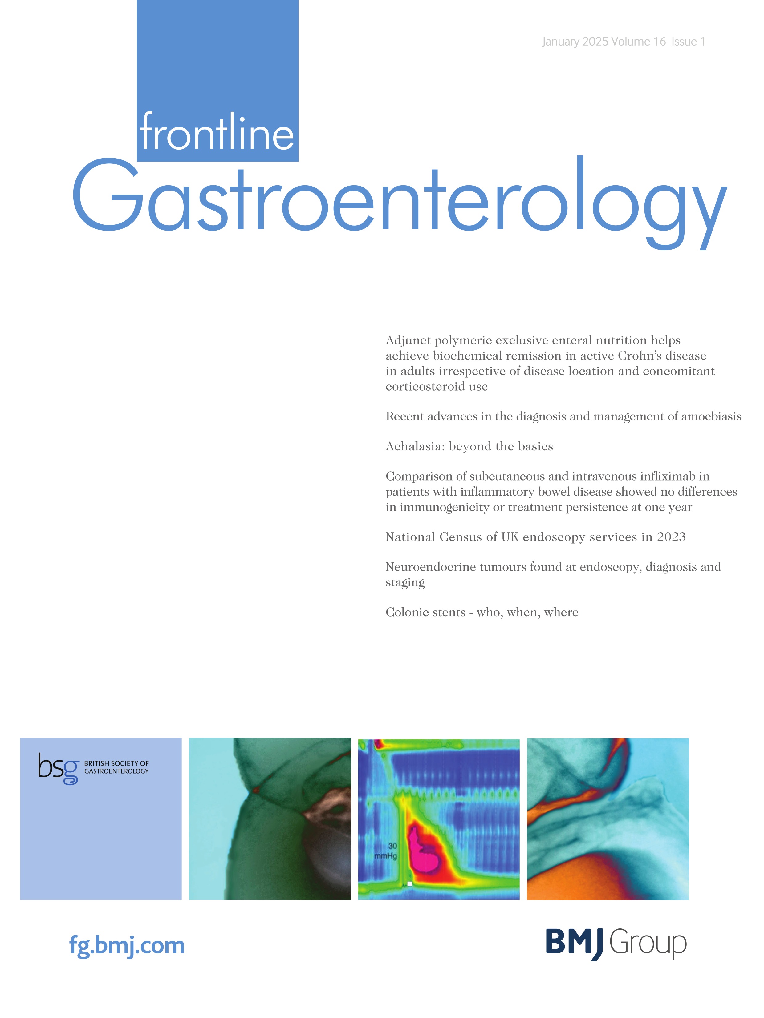 Achalasia: beyond the basics