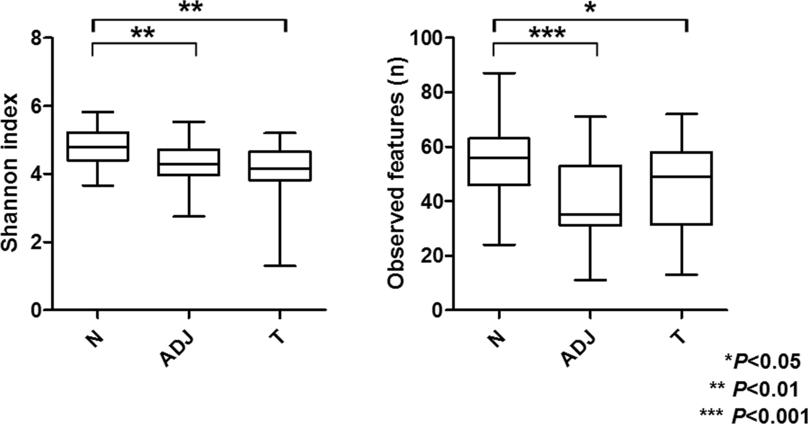 Distinct microbiome dysbiosis and epigenetic anomaly in esophageal adenocarcinoma and its underlying Barrett’s esophagus