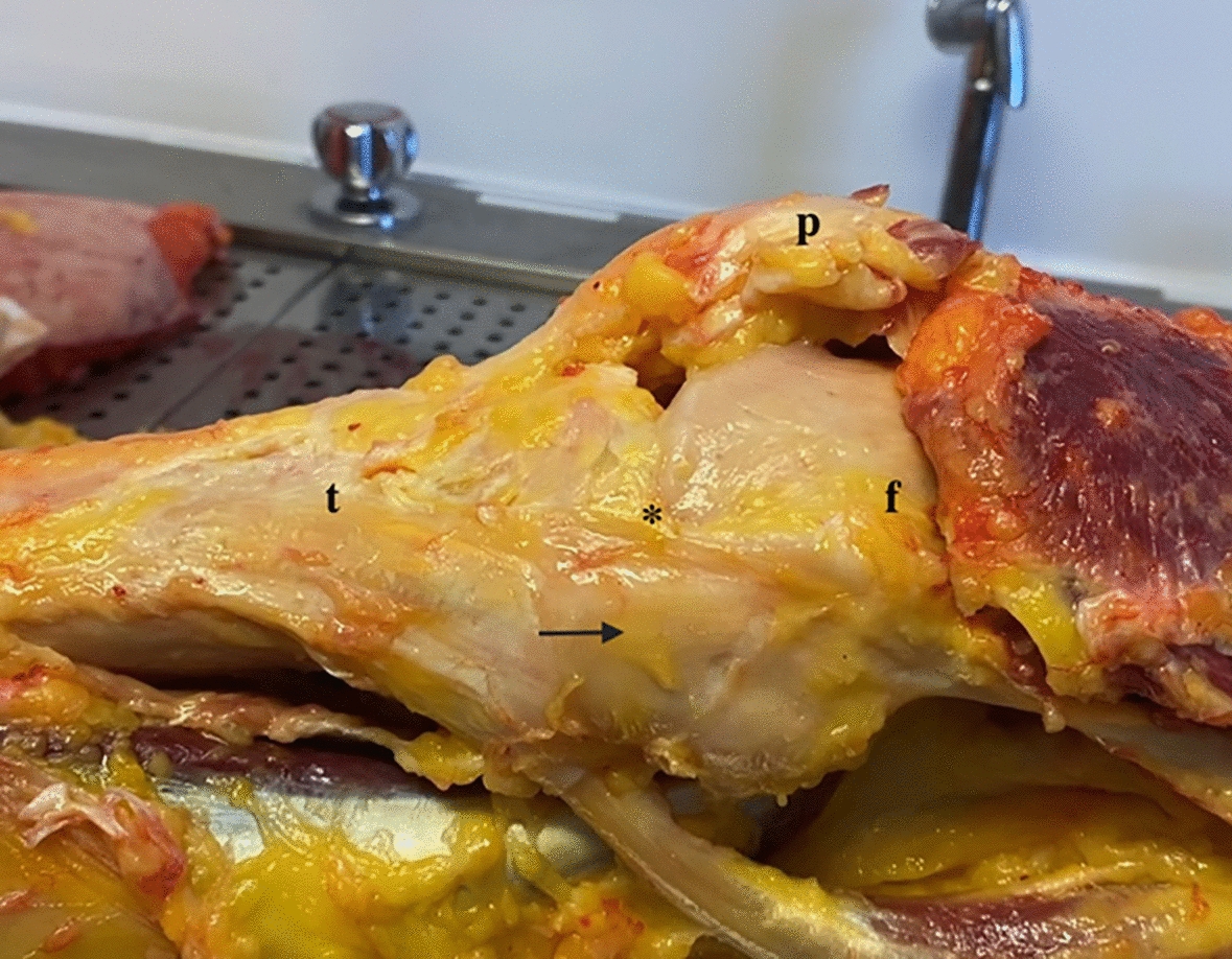 Current trends in the medial side of the knee: not only medial collateral ligament (MCL)