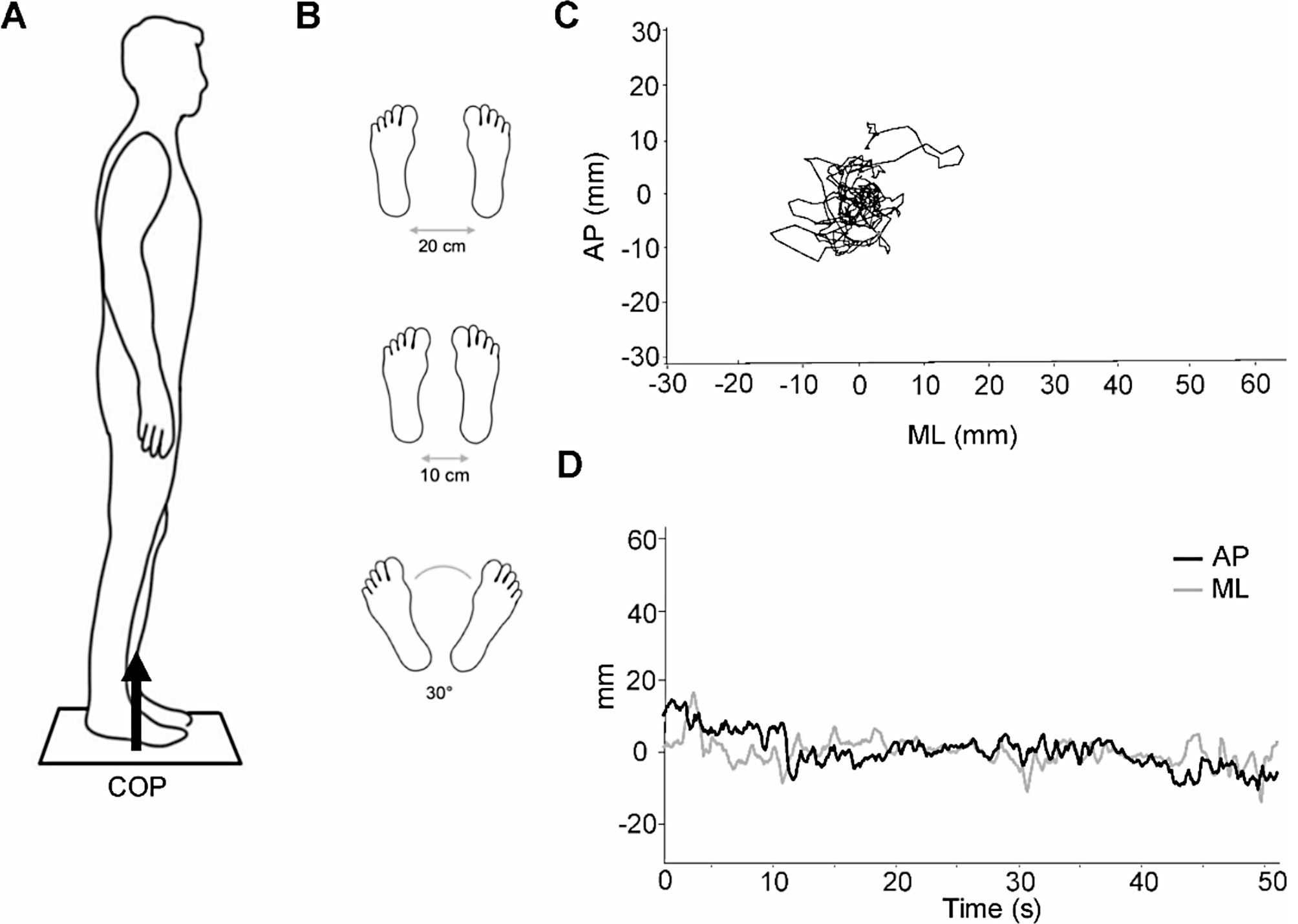 Dynamical complexity of postural control system in autism spectrum disorder: a feasibility study of linear and non-linear measures in posturographic analysis of upright posture