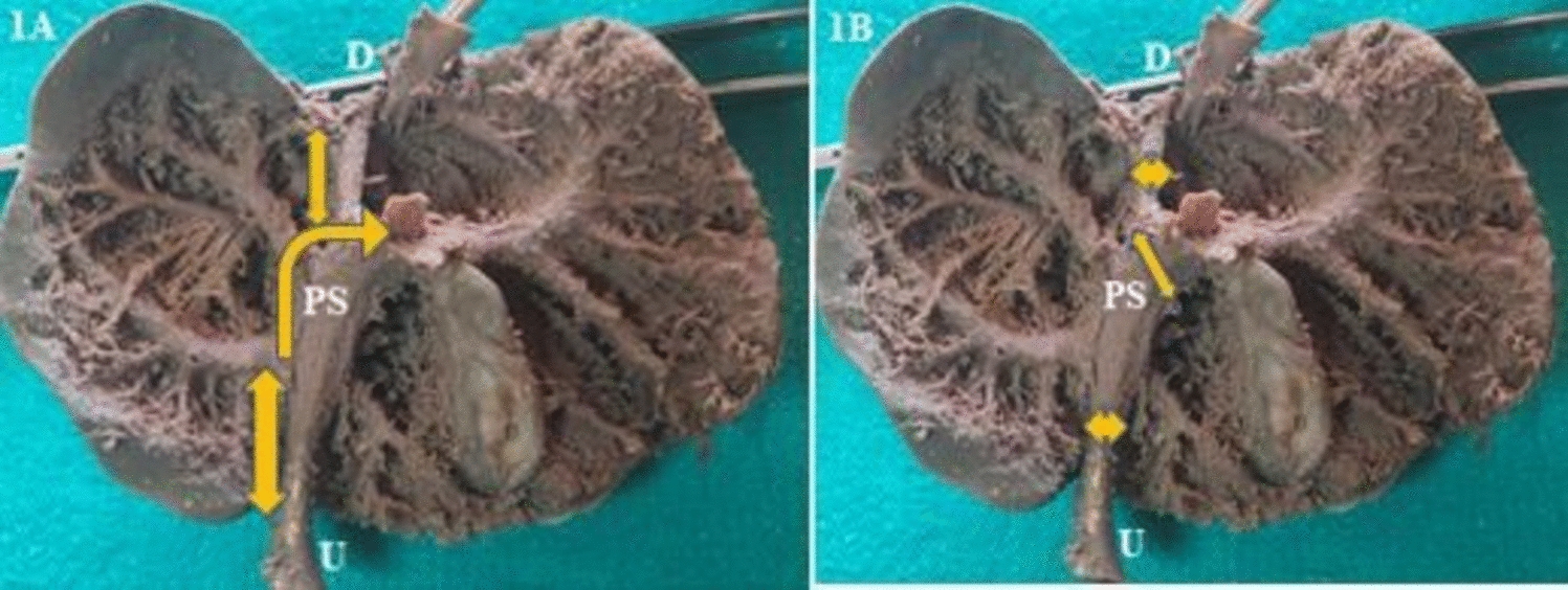 Morphometry, variations, and histogenesis of umbilical vein, portal sinus, and ductus venosus in human fetal liver: an anatomical study