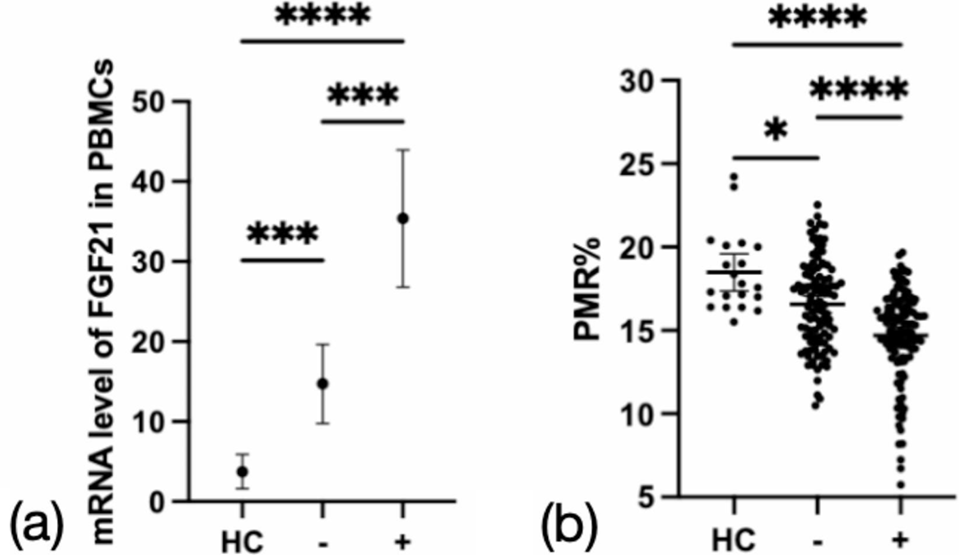 The value of promoter methylation of fibroblast factor 21 (FGF21) in predicting the course of chronic hepatitis B and the occurrence of oxidative stress