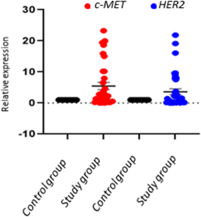 Clinicopathological significance of c-MET and HER2 altered expression in bladder cancer