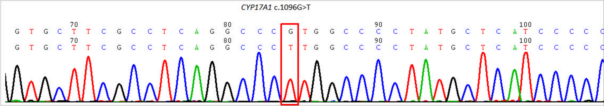 An isolated 17,20-lyase deficiency patient achieved a successful live birth after in vitro fertilization: a case report and narrative review