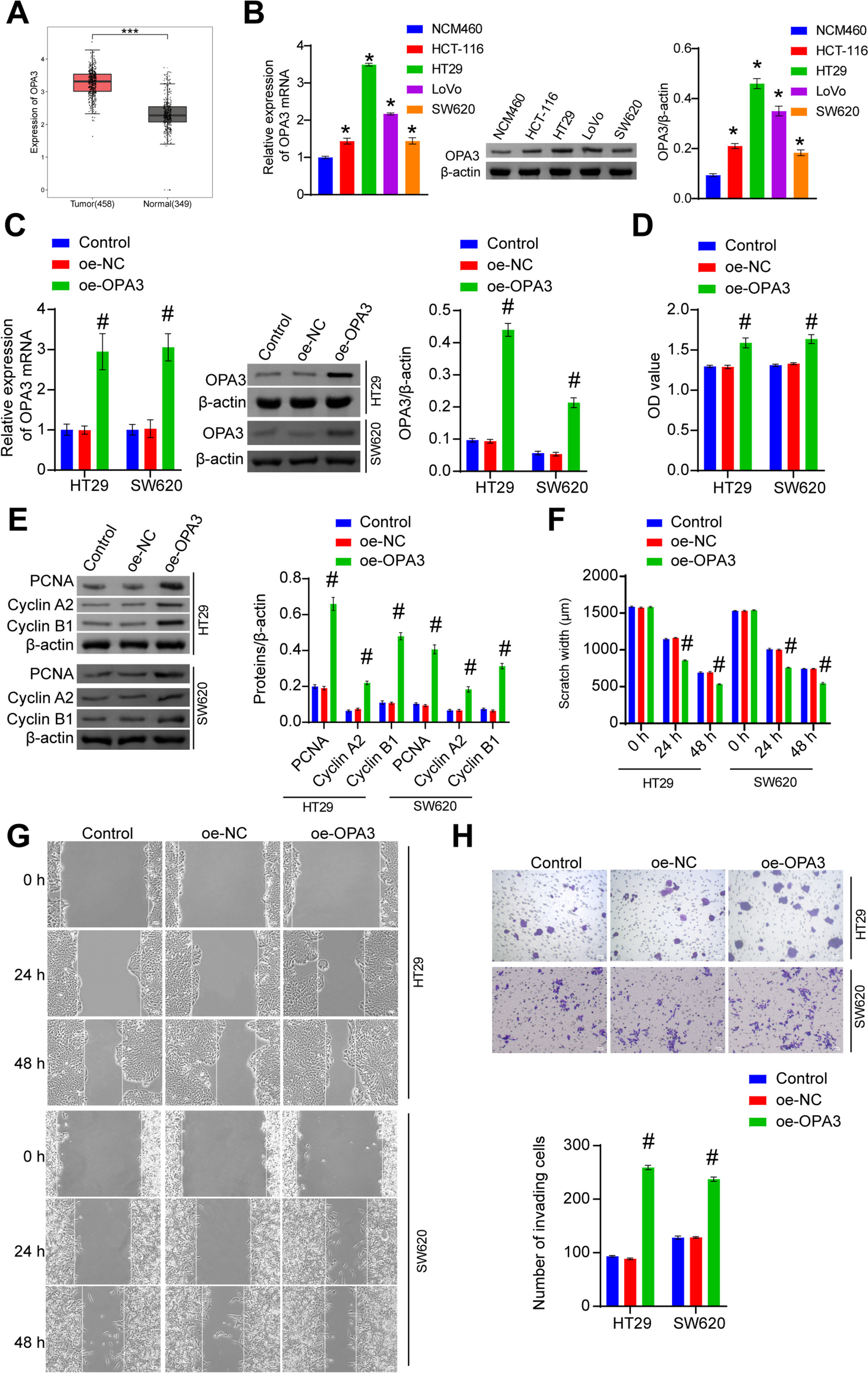 OPA3 inhibits the cGAS-STING pathway mediated by mtDNA stress to promote colorectal cancer progression