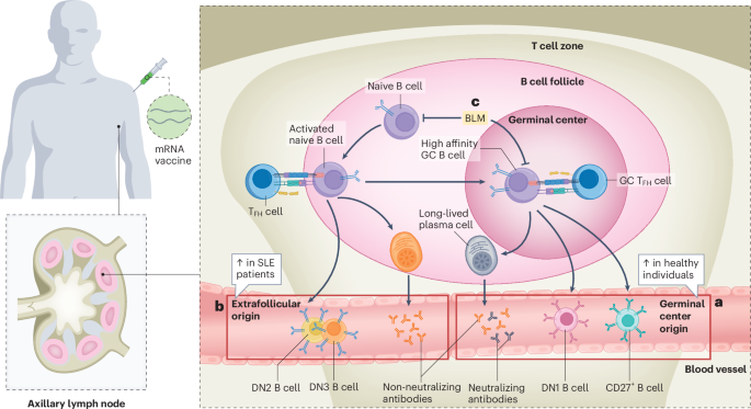 SLE B cells take an extrafollicular detour after mRNA vaccination