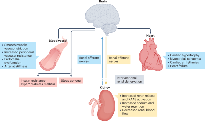 Renal denervation for hypertension