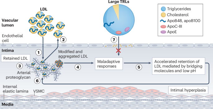 Apolipoprotein B-containing lipoproteins in atherogenesis