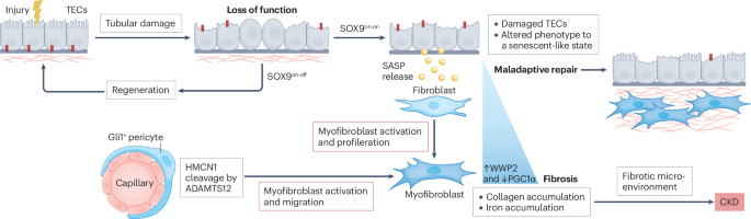 Insights into the mechanisms of fibrosis and progressive kidney injury