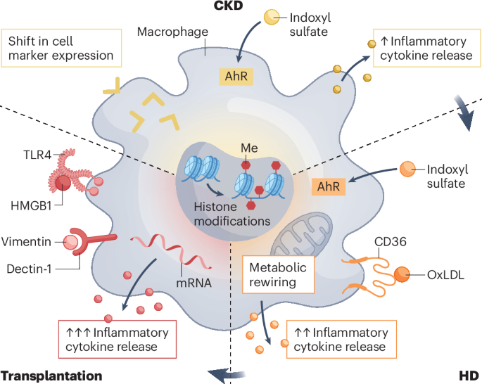 Trained immunity: from kidney failure to organ transplantation