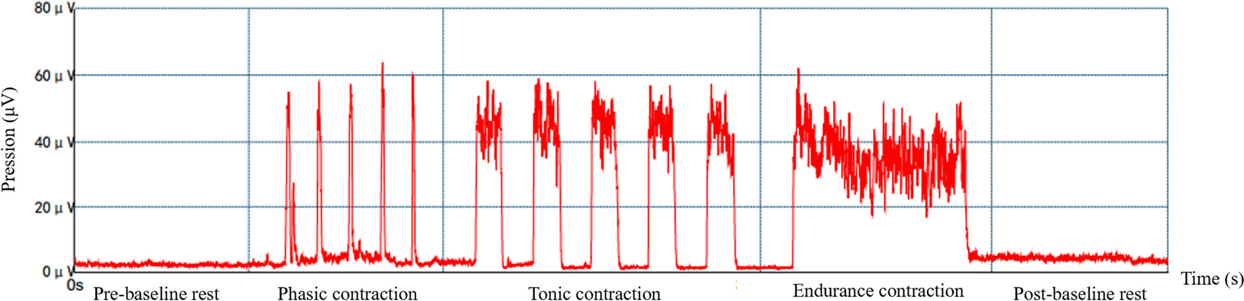 Association Between Cesarean Scar and Pelvic Floor Muscle Tone at 6–8 Weeks Postpartum