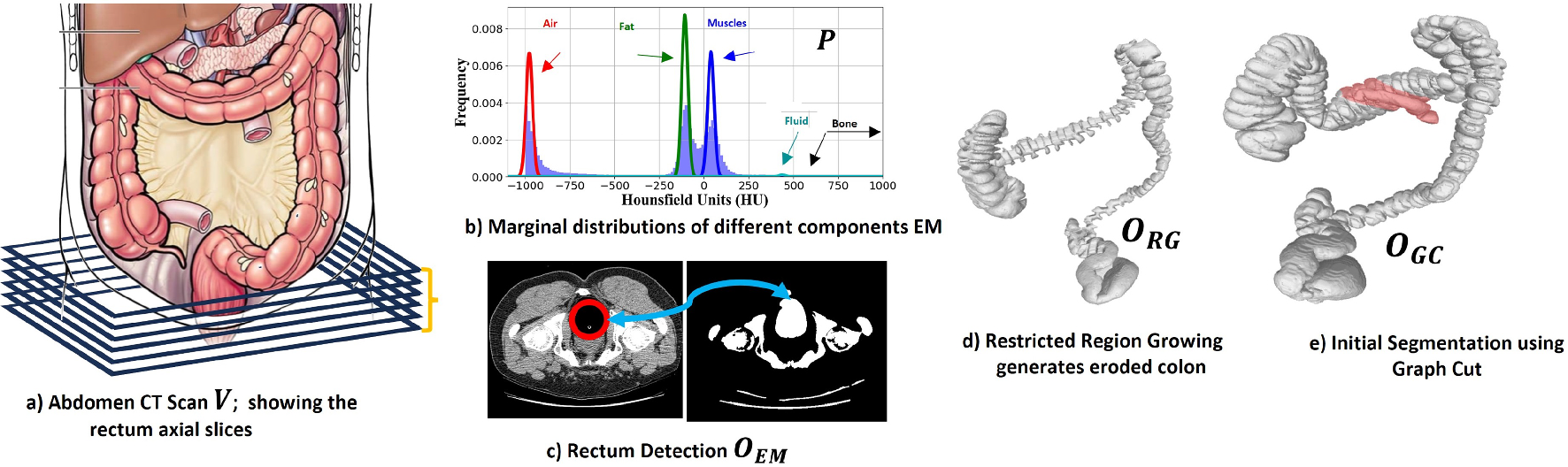 G-SET-DCL: a guided sequential episodic training with dual contrastive learning approach for colon segmentation