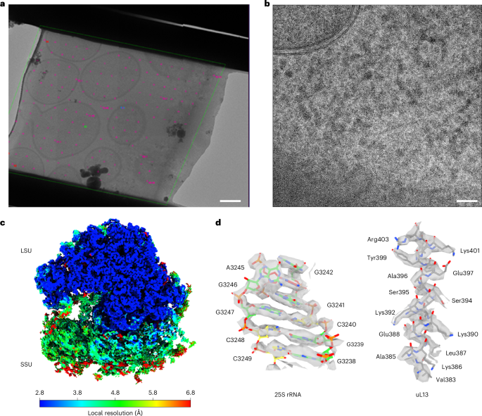 Capturing eukaryotic ribosome dynamics in situ at high resolution