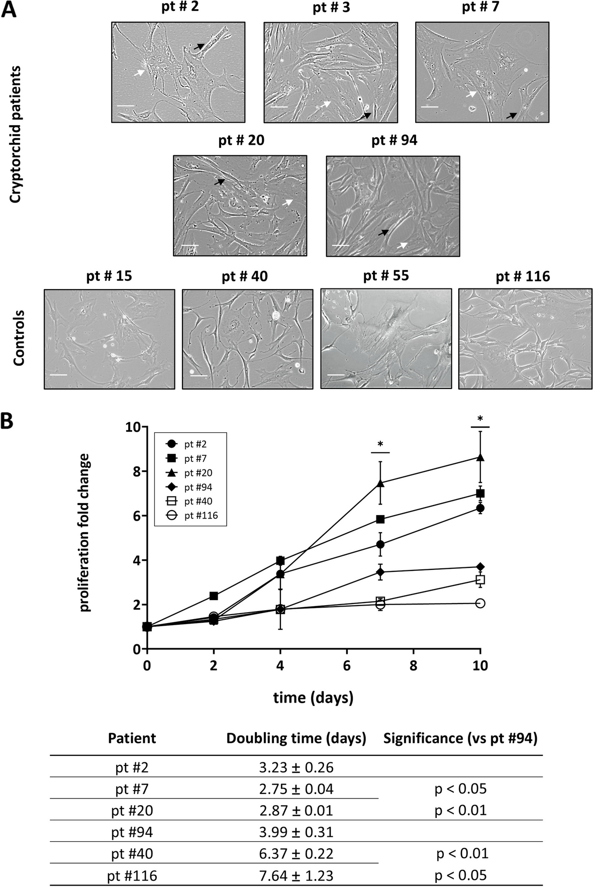 In vitro effect of hCG on cryptorchid patients’ gubernacular cells: a predictive model for adjuvant personalized therapy