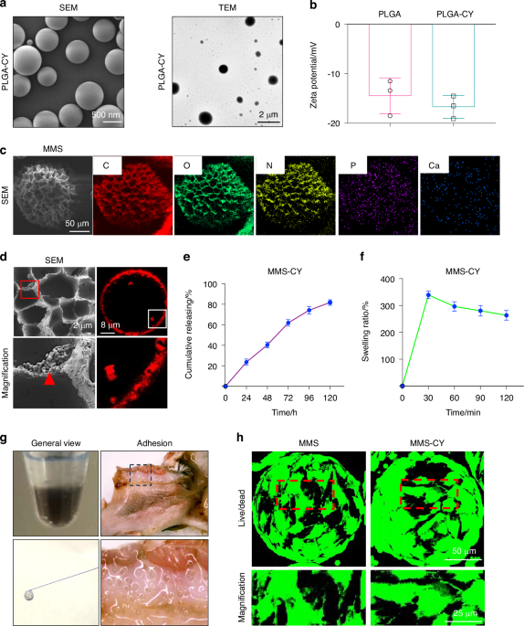 Adhesive and injectable hydrogel microspheres for NRF2-mediated periodontal bone regeneration