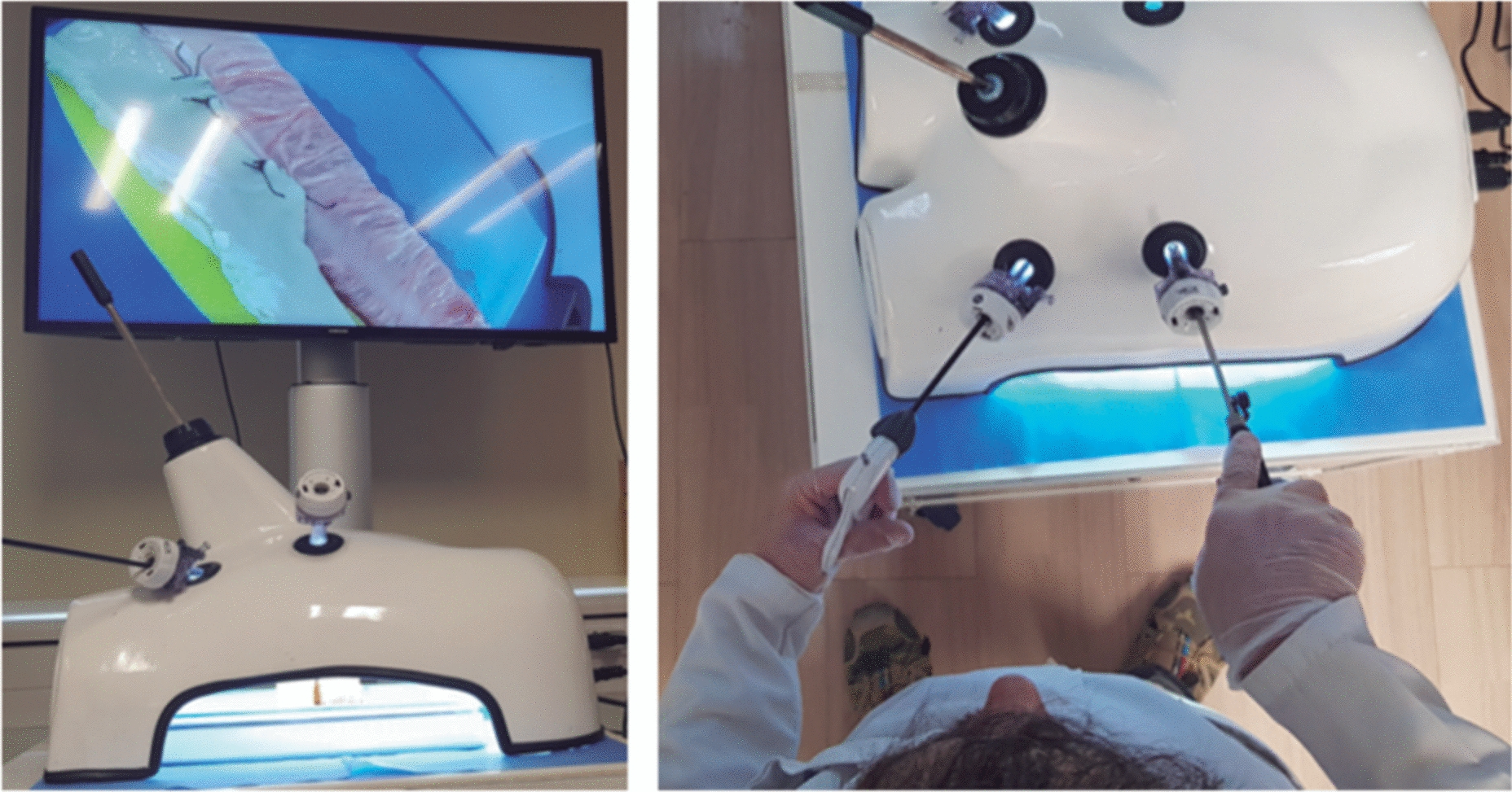 Design and validation of a simulation-based training module for ileo-transverse intracorporeal anastomosis