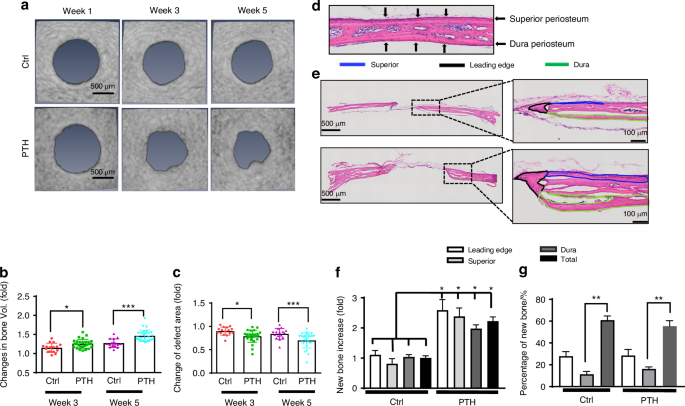 Differential bone and vessel type formation at superior and dura periosteum during cranial bone defect repair