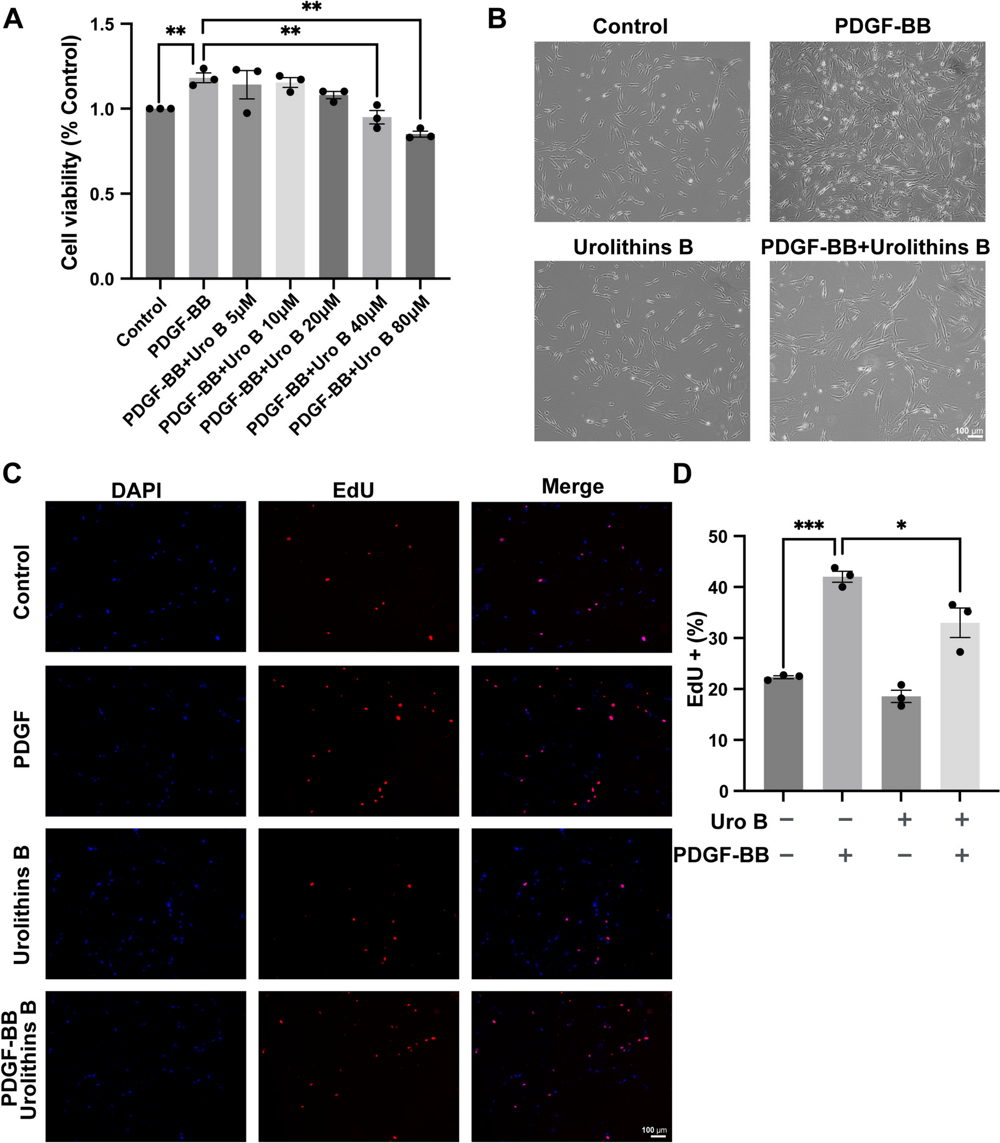 Urolithin B suppresses phenotypic switch in vascular smooth muscle cells induced by PDGF-BB via inhibiting the PI3K-AKT pathway