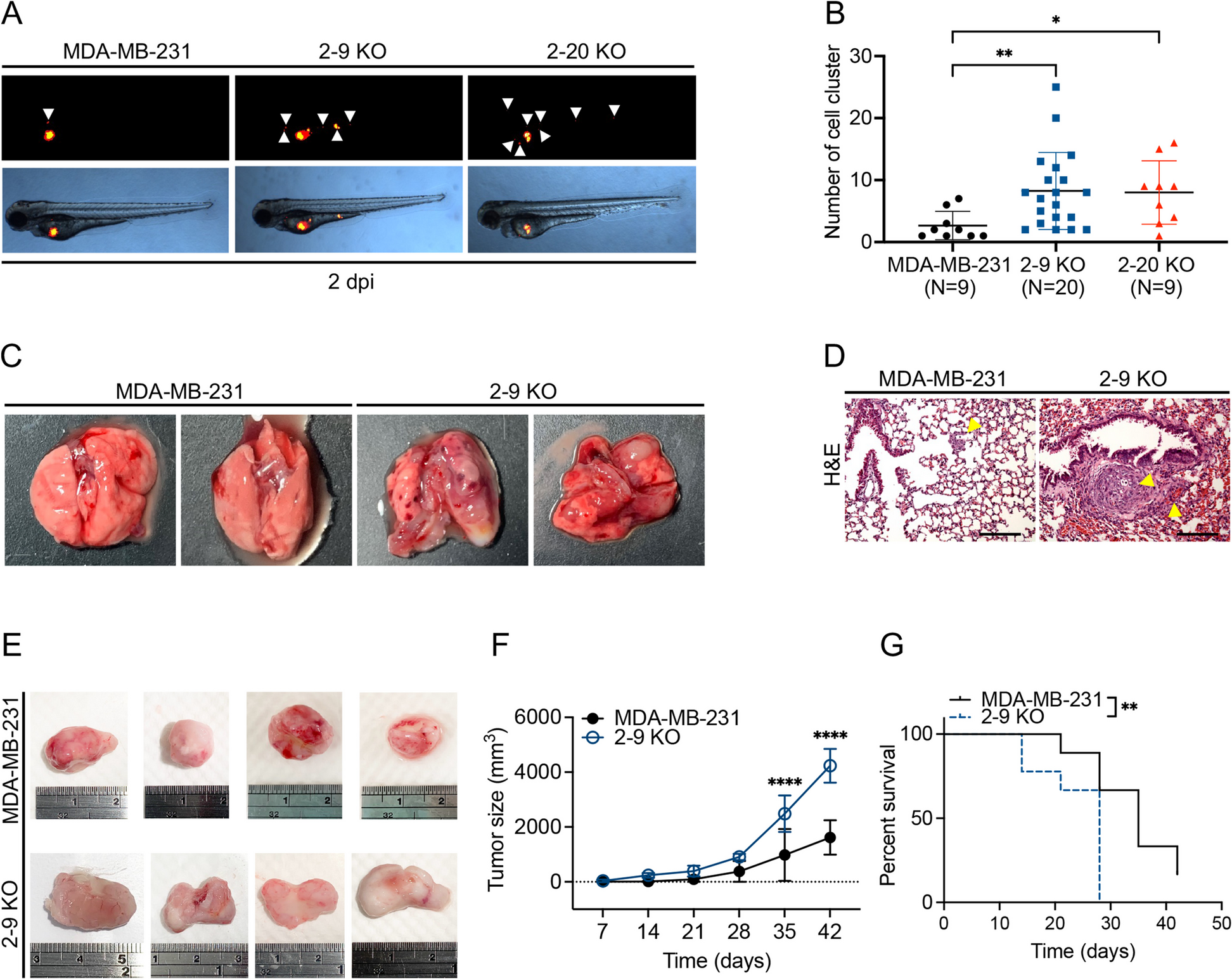 Targeting the ERK1/2 and p38 MAPK pathways attenuates Golgi tethering factor golgin-97 depletion-induced cancer progression in breast cancer