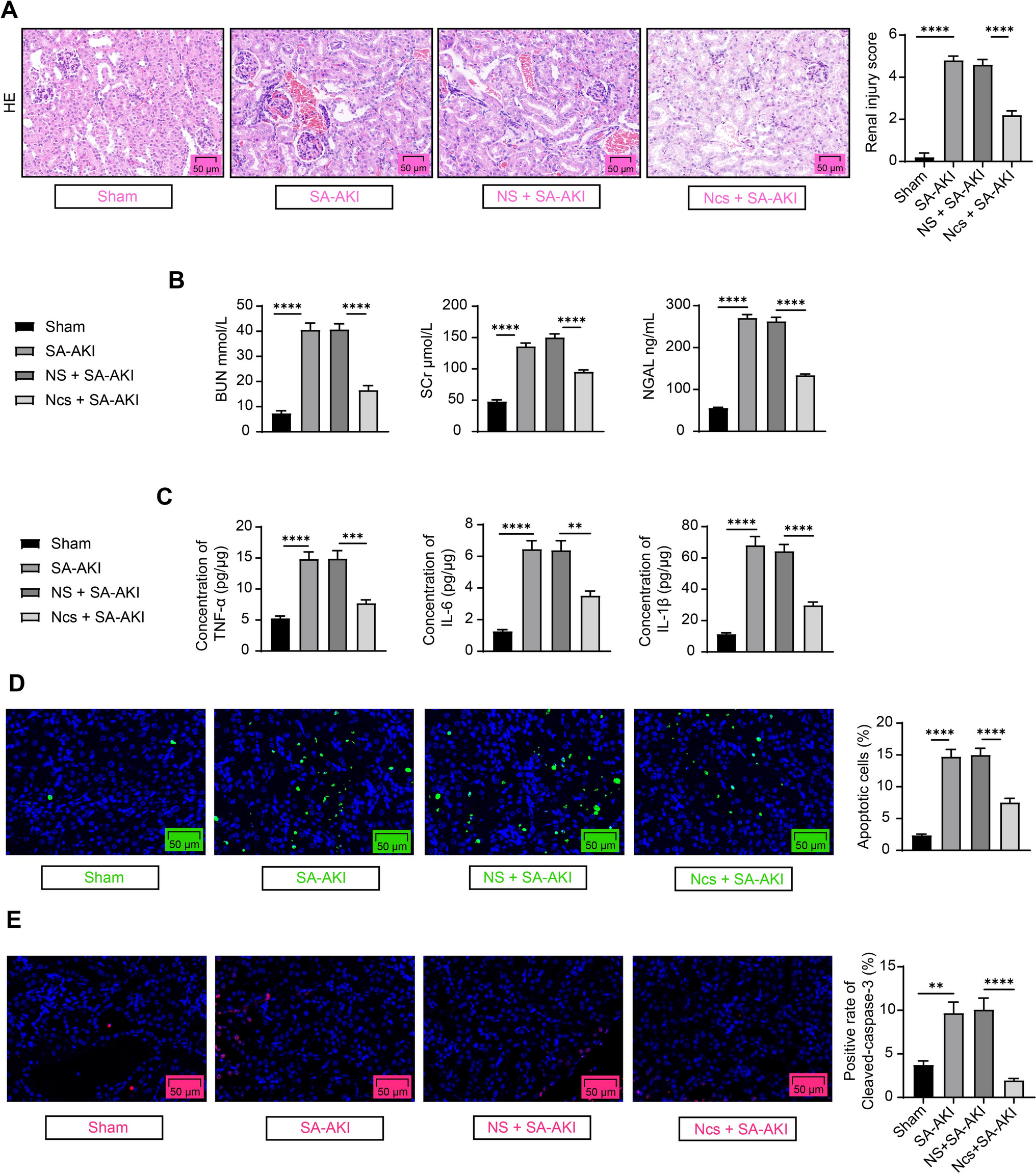 Narciclasine attenuates sepsis-associated acute kidney injury through the ESR1/S100A11 axis