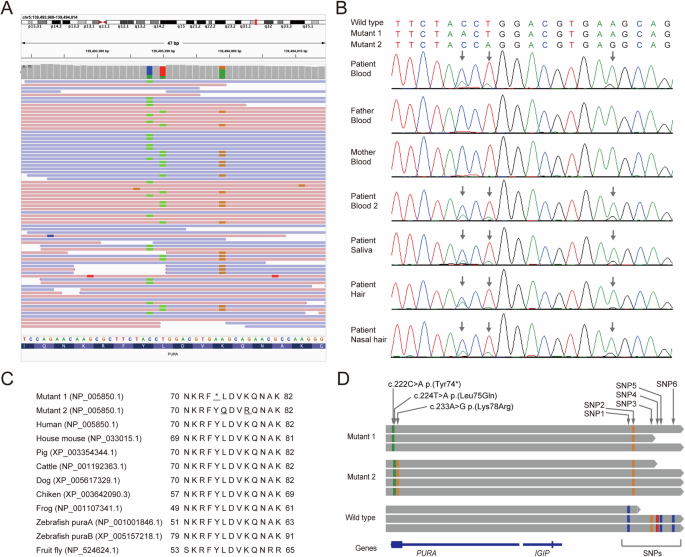 Triple mosaic variants of PURA in a patient with multiple congenital anomalies