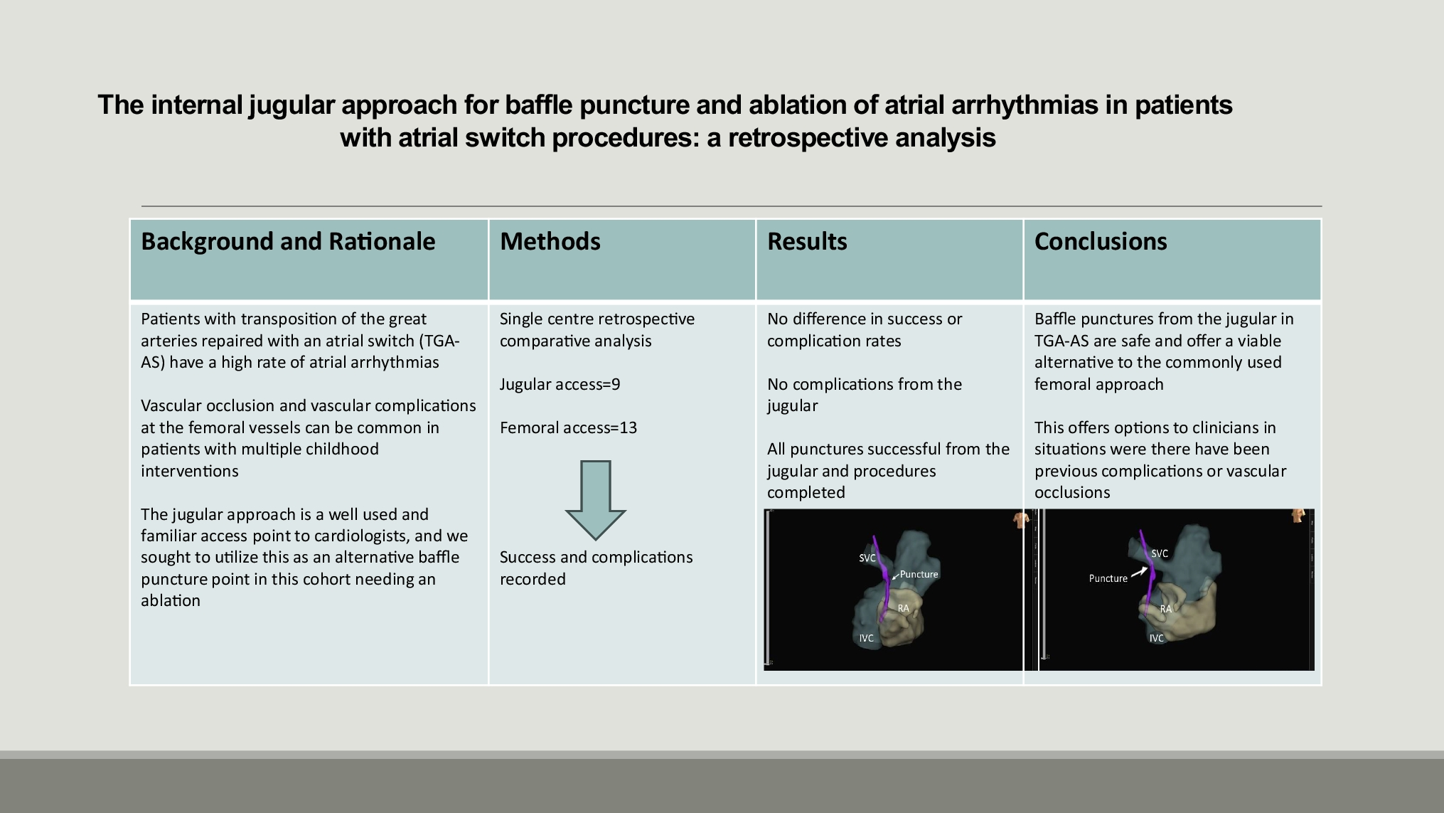 The internal jugular approach for baffle puncture and ablation of atrial arrhythmias in patients with atrial switch procedures: a retrospective analysis