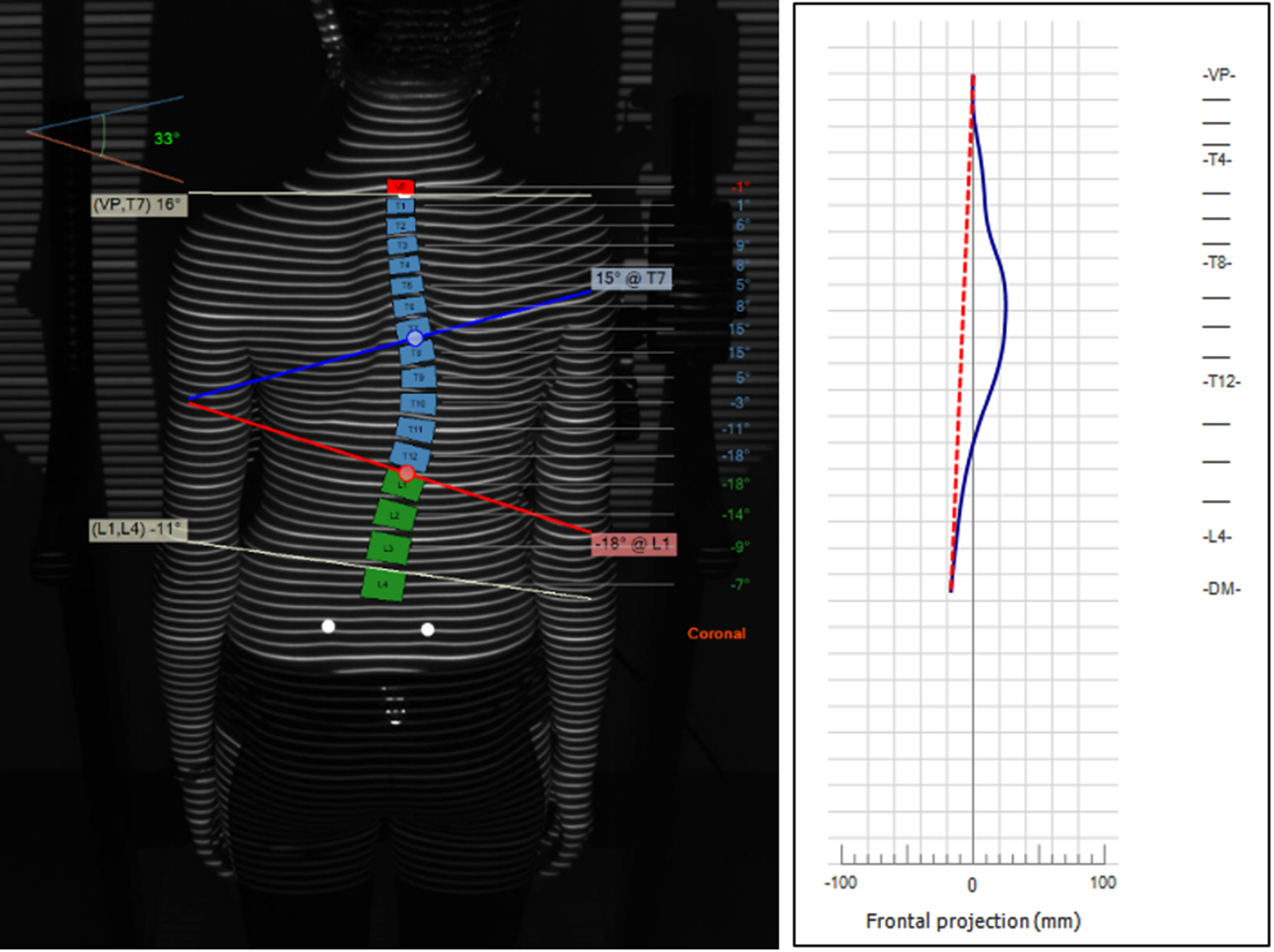 Can surface topography reliably determine the Rigo classification system?