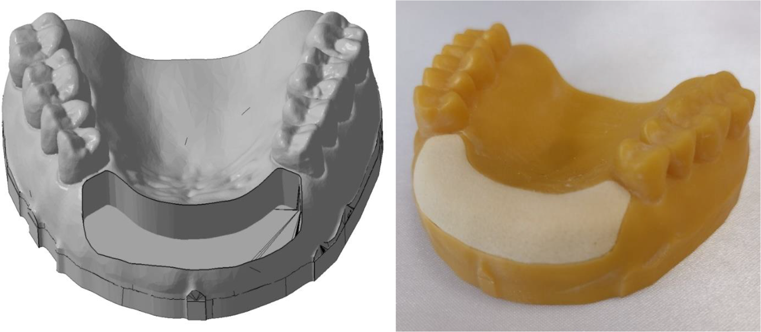 Smartphone application-based augmented reality for pre-clinical dental implant placement training: a pilot study