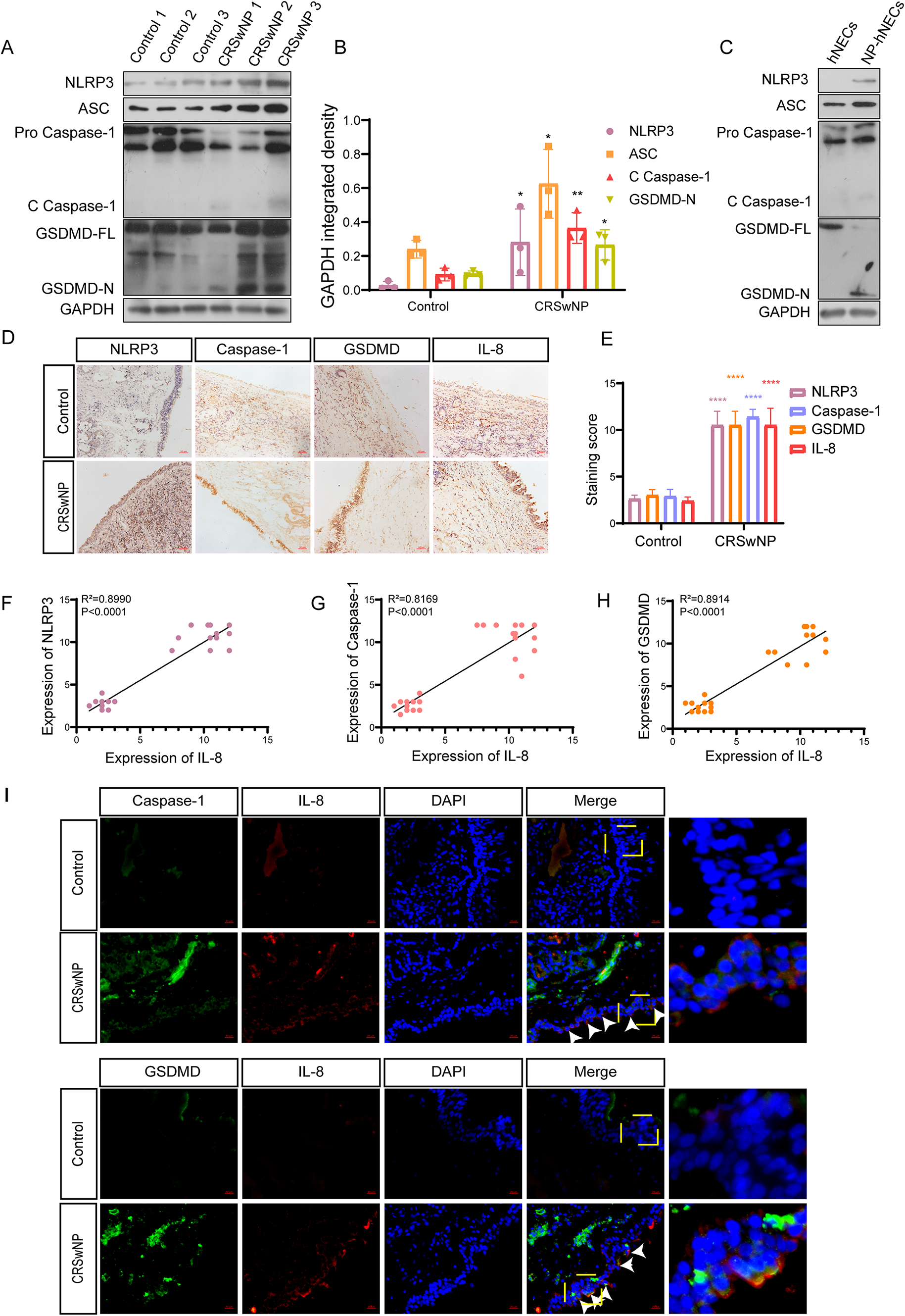 IL-8 promotes pyroptosis through ERK pathway and mediates glucocorticoid resistance in chronic rhinosinusitis with nasal polyps