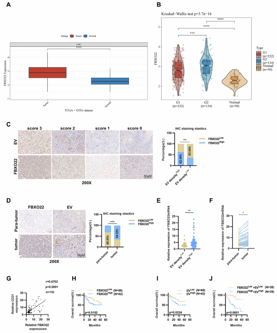 FBXO22 promotes HCC angiogenesis and metastasis via RPS5/AKT/HIF-1α/VEGF-A signaling axis