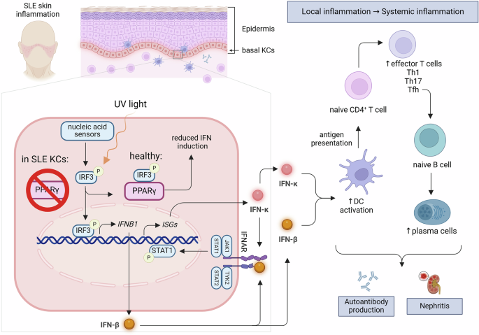 Increasing evidence for the pathogenic role of keratinocytes in lupus