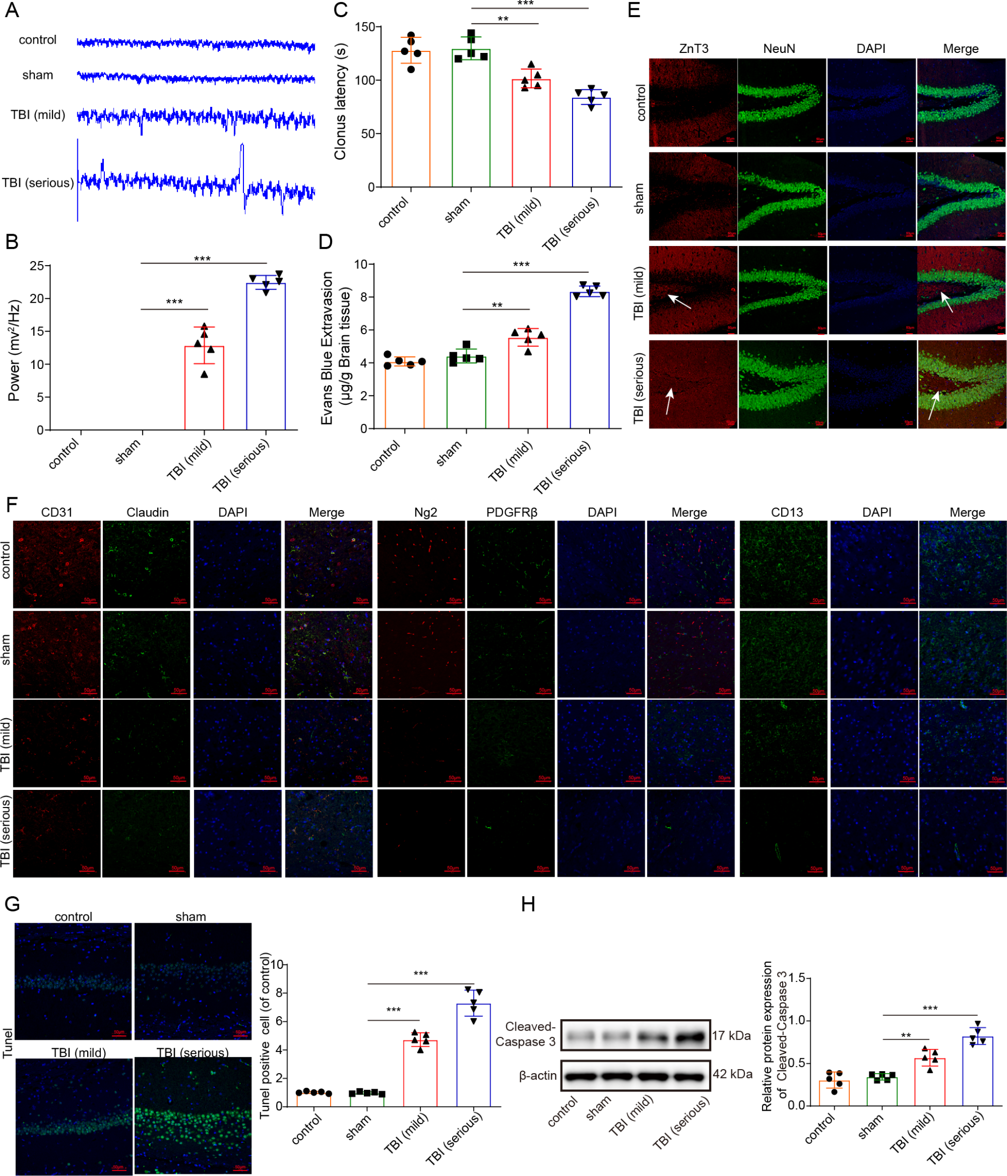 Overexpression of FTO alleviates traumatic brain injury induced posttraumatic epilepsy by upregulating NR4A2 expression via m6A demethylation