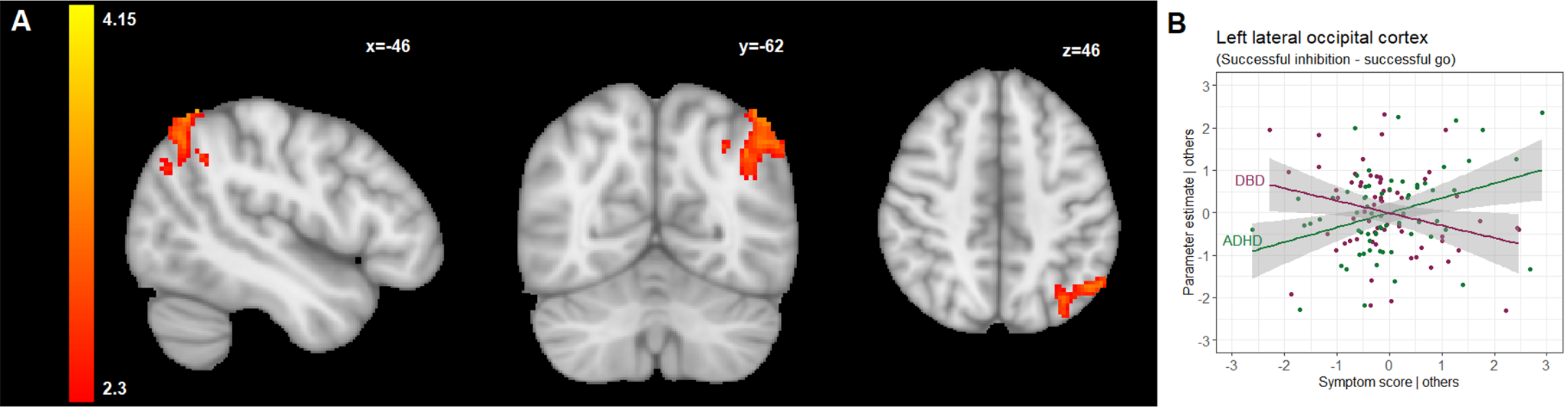 Disentangling the neural underpinnings of response inhibition in disruptive behavior and co-occurring ADHD