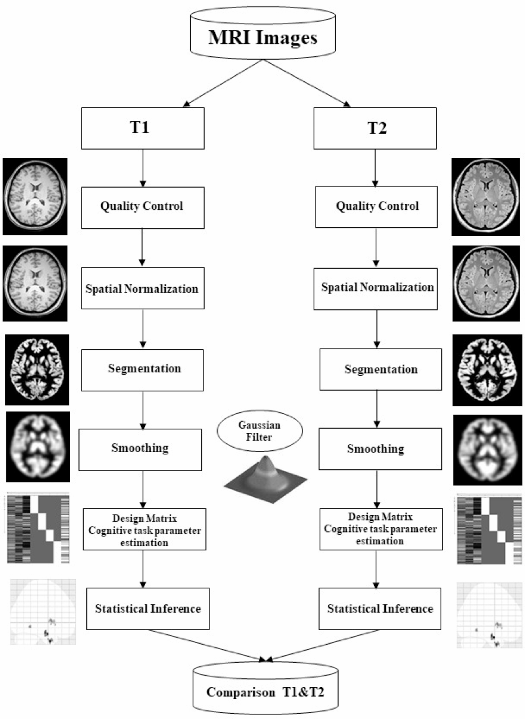 Comparative analysis of Voxel-based morphometry using T1 and T2-weighted magnetic resonance imaging to explore the relationship between brain structure and cognitive abilities