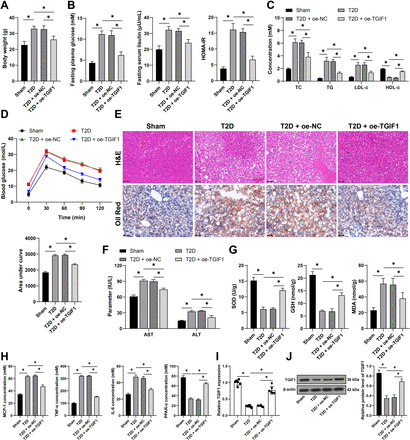 Mechanism of TGIF1 on glycolipid metabolism disorders in mice with type 2 diabetes