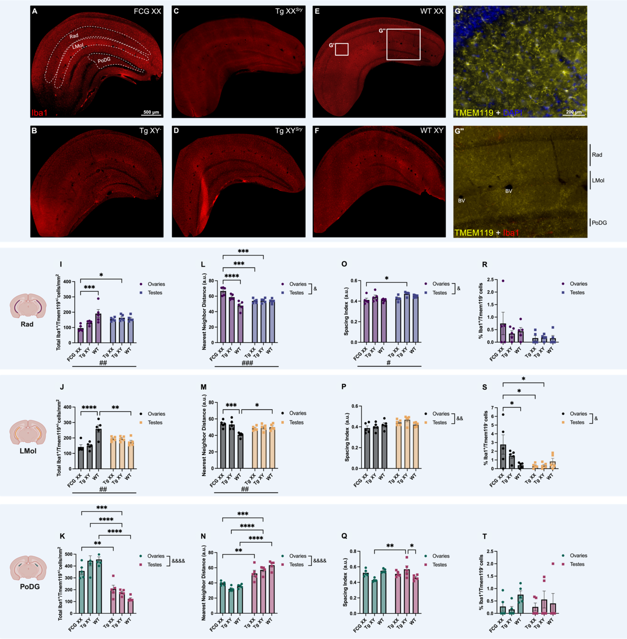 Sex chromosomes and sex hormones differently shape microglial properties during normal physiological conditions in the adult mouse hippocampus