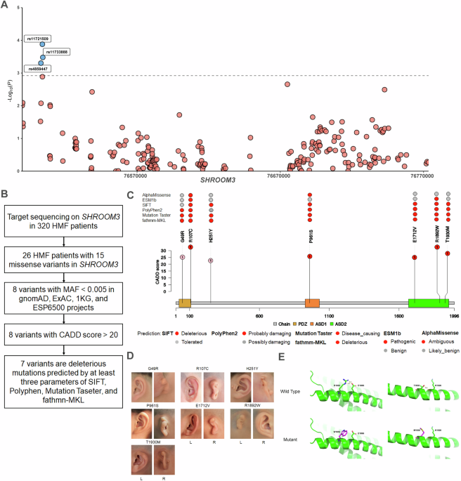 Pathogenic variants in SHROOM3 associated with hemifacial microsomia