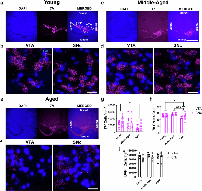 Aging disrupts the coordination between mRNA and protein expression in mouse and human midbrain