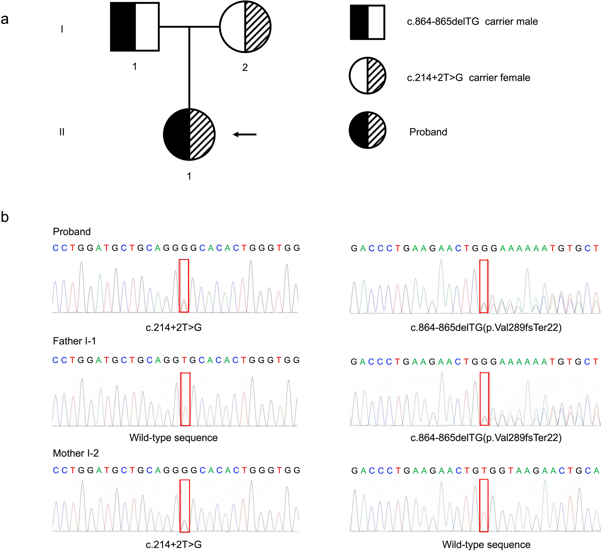 Identification of a novel GRHPR mutation in primary hyperoxaluria type 2 and establishment of patient-derived iPSC line