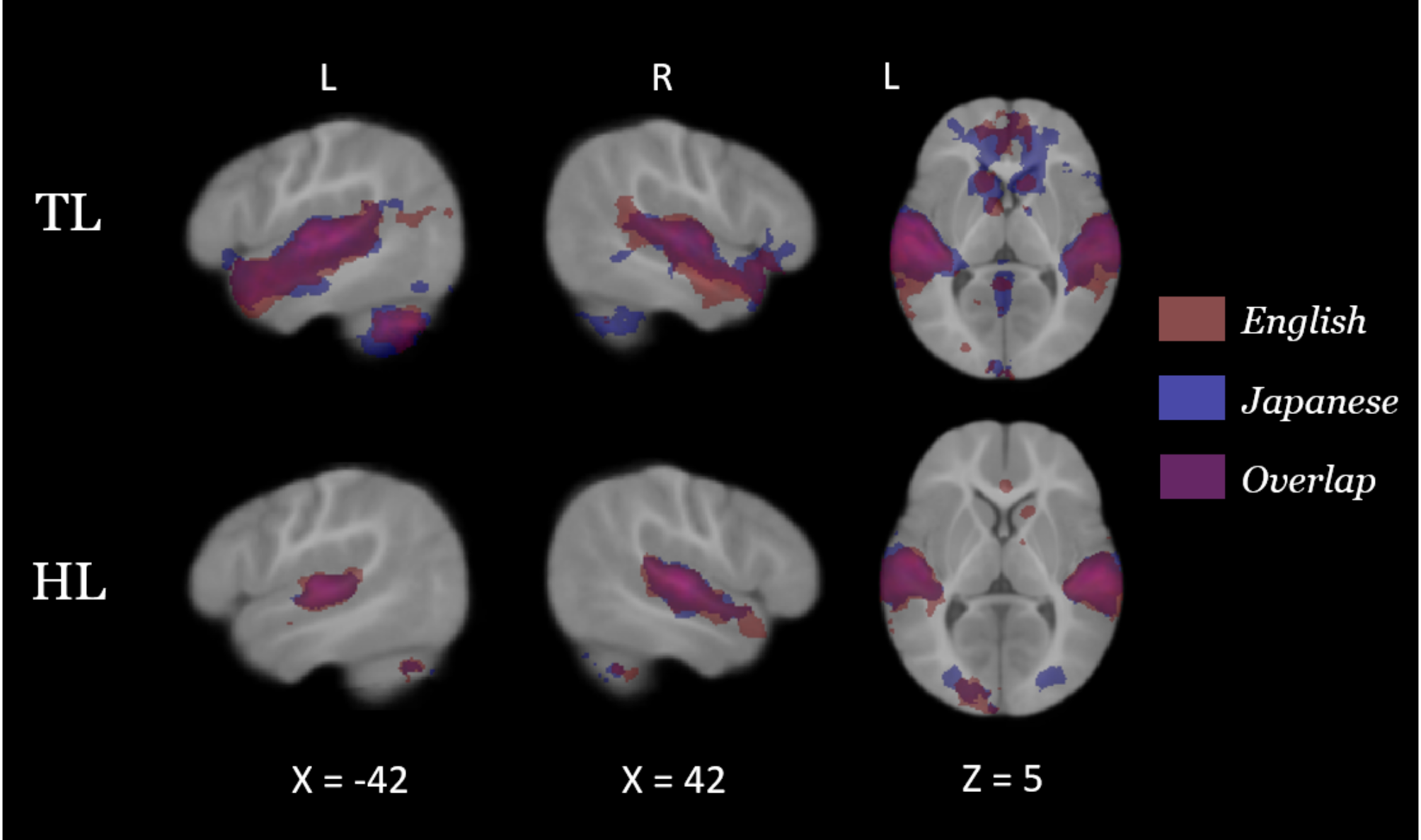 Atypical early neural responses to native and non-native language in infants at high likelihood for developing autism