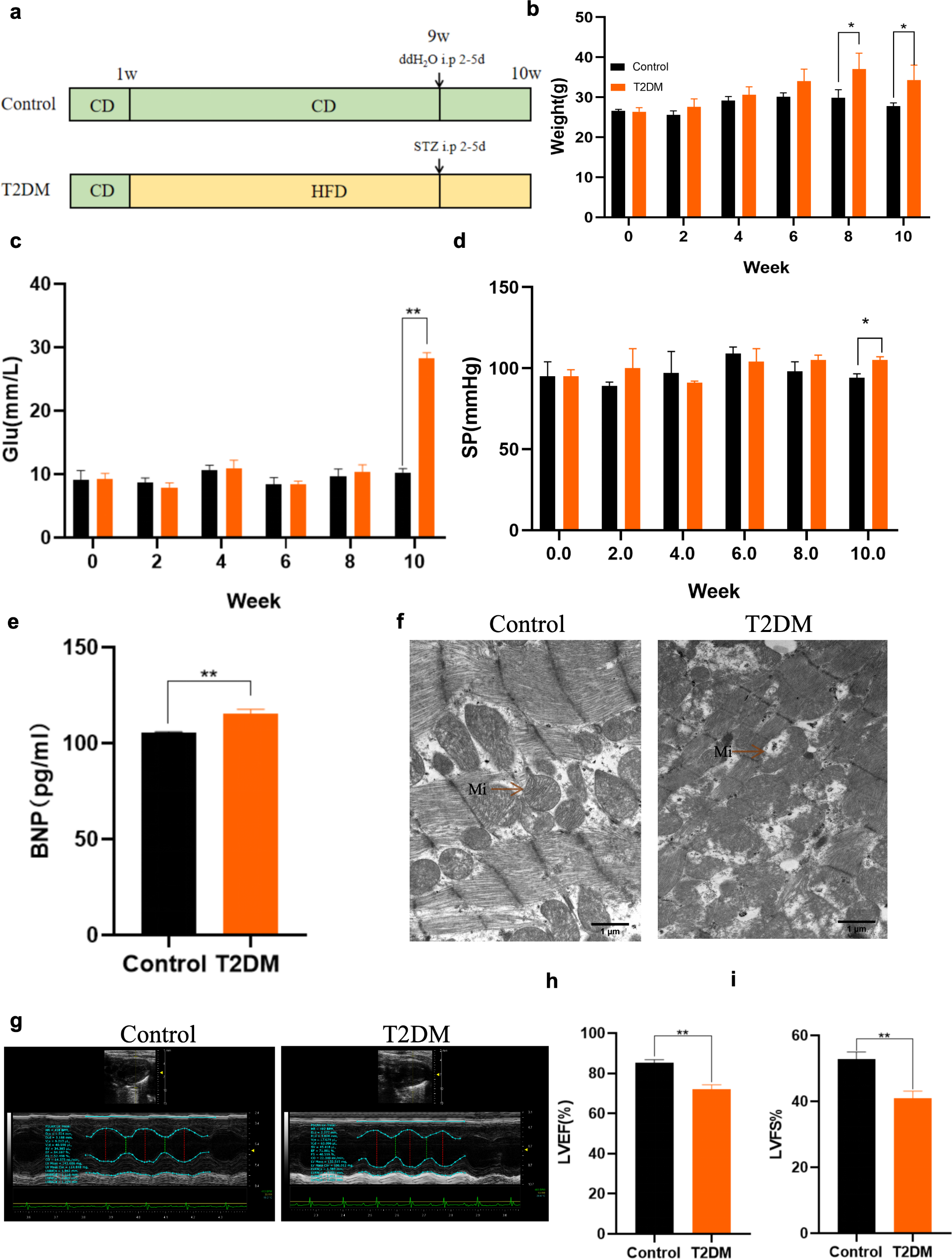 Roxadustat improves diabetic myocardial injury by upregulating HIF-1α/UCP2 against oxidative stress