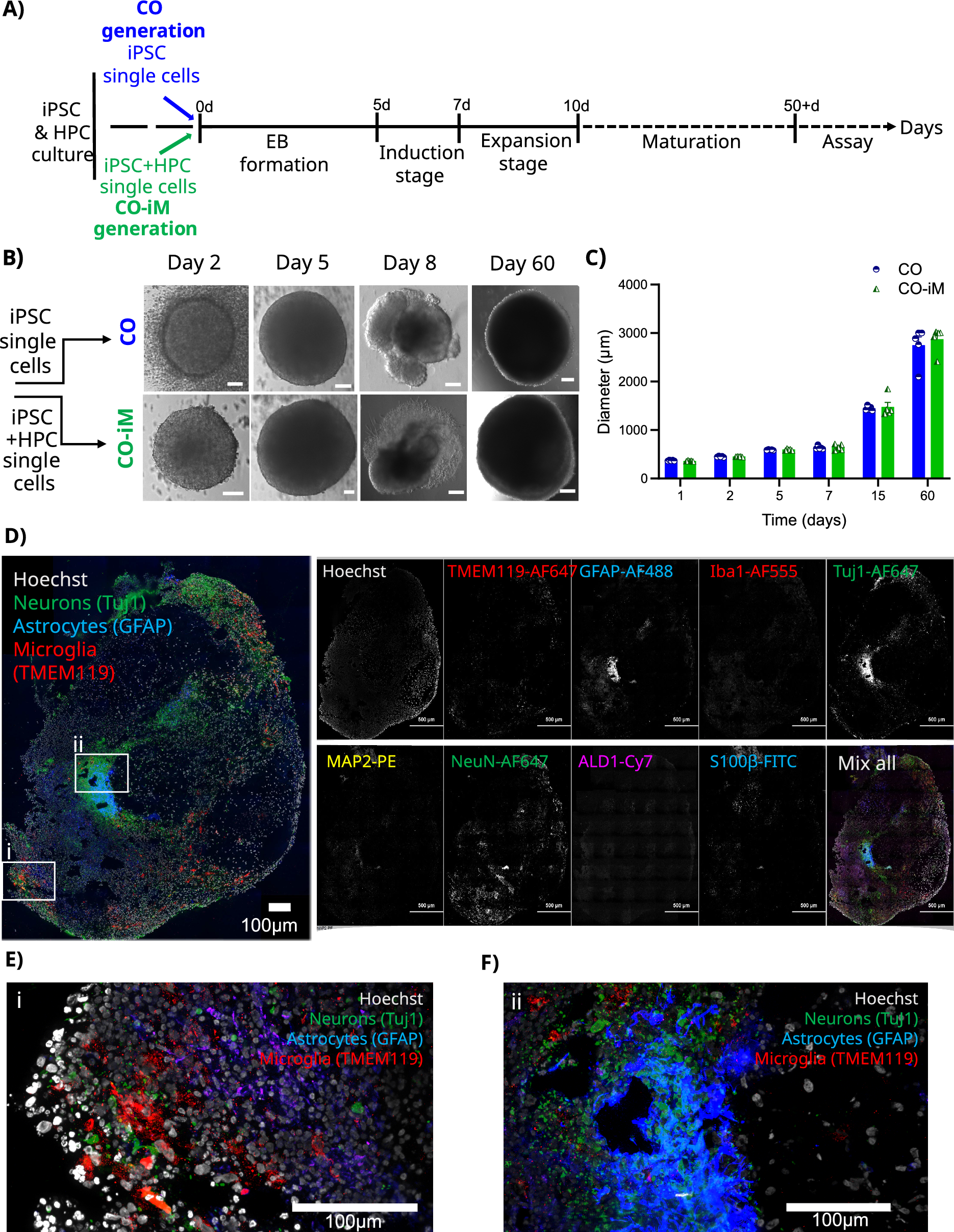 Inflammatory responses revealed through HIV infection of microglia-containing cerebral organoids