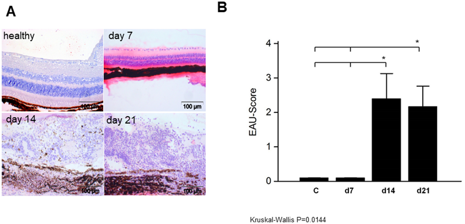 Kinetic changes in microglia-related retinal transcripts in experimental autoimmune uveoretinitis (EAU) of B10.RIII mice