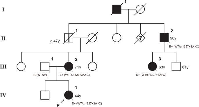 Novel FBN1 intron variant causes isolated ectopia lentis via in-frame exon skipping