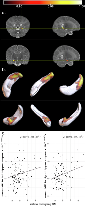 Associations between maternal pre-pregnancy BMI and mean diffusivity of the hippocampus and amygdala in infants