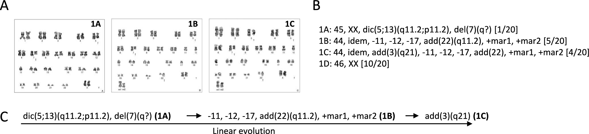 Karyotype evolution of myelodysplastic syndrome and acute myeloid leukemia with TP53 mutations